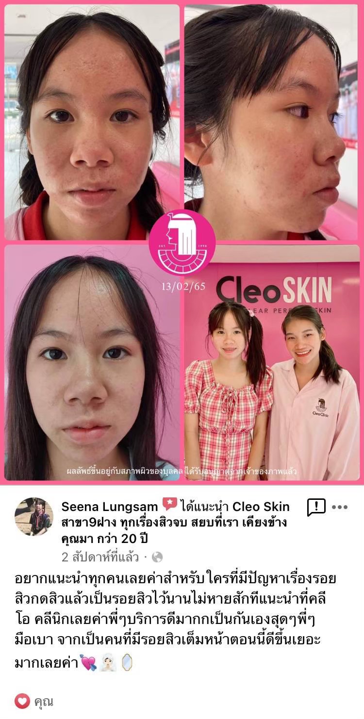 รีวิว ปี 62