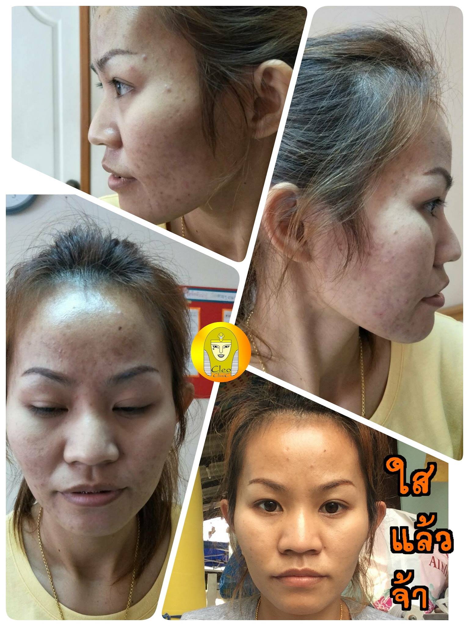 รีวิว ปี 62