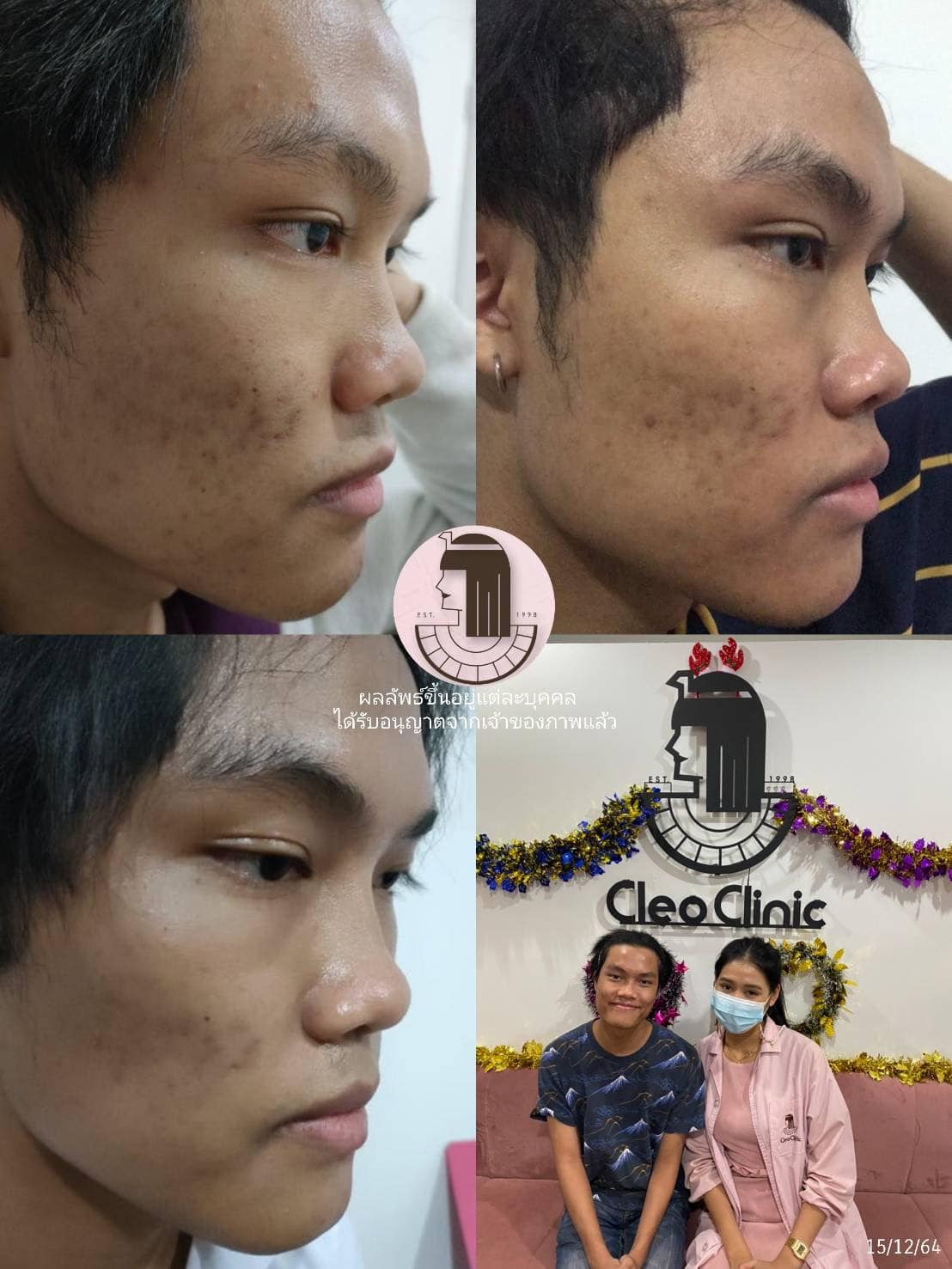 รีวิว ปี 62