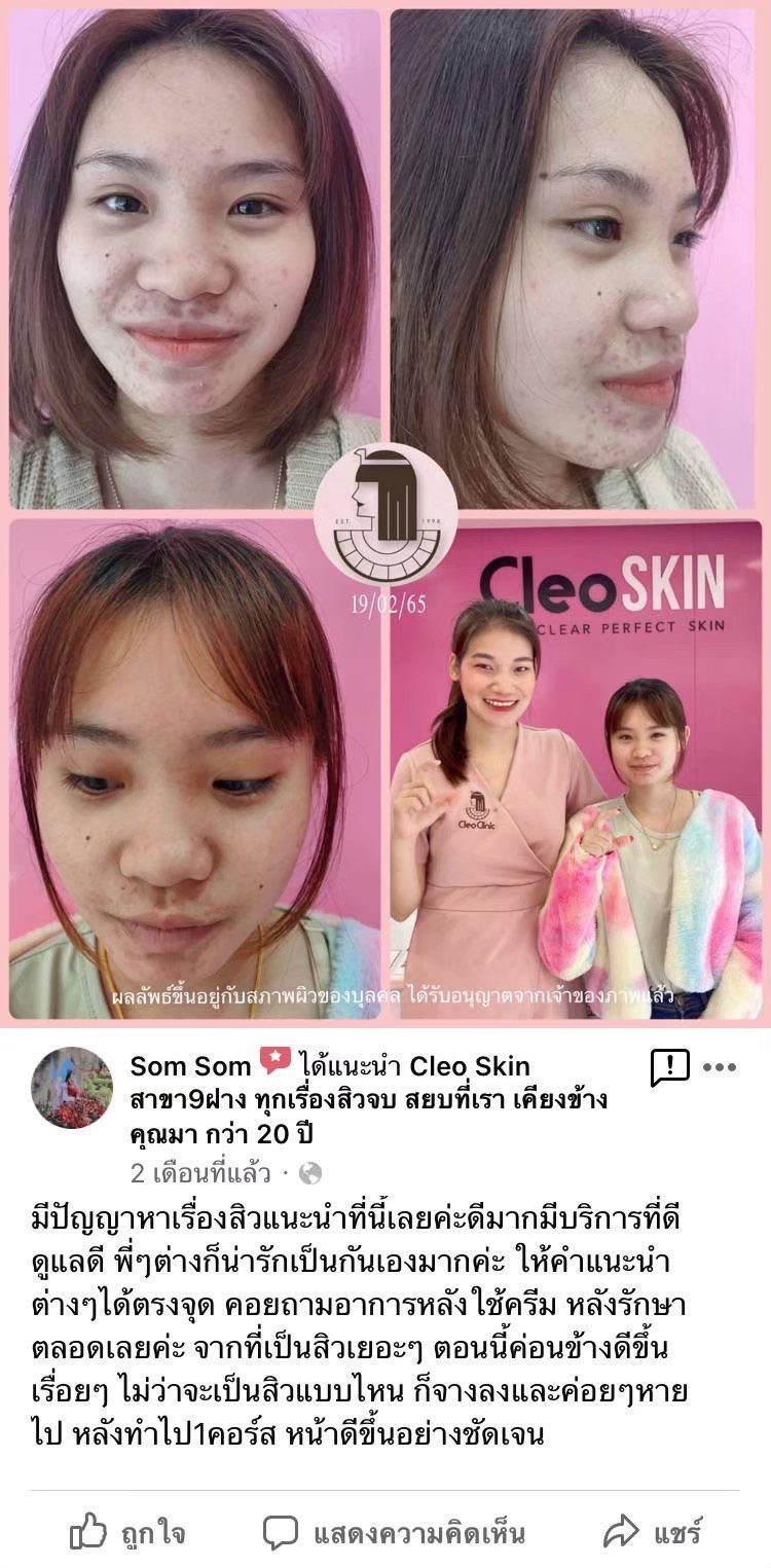 รีวิว ปี 62