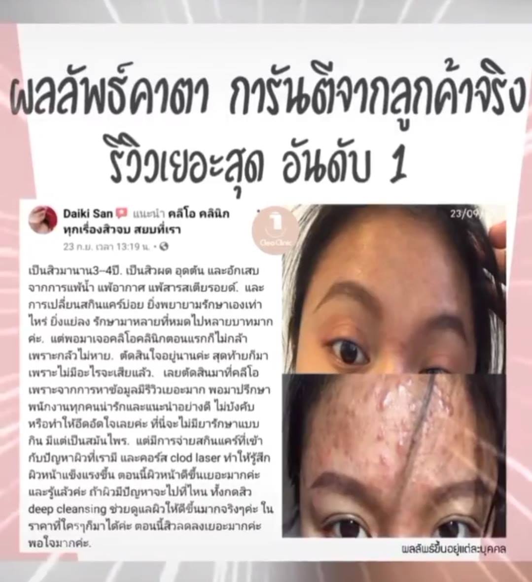 รีวิว ปี 62