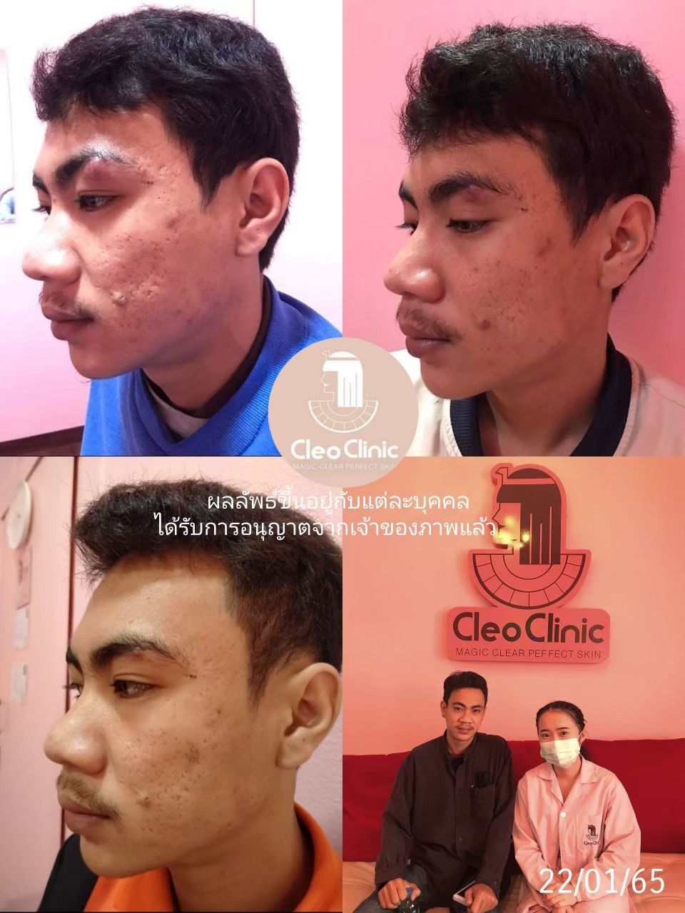 รีวิว ปี 62