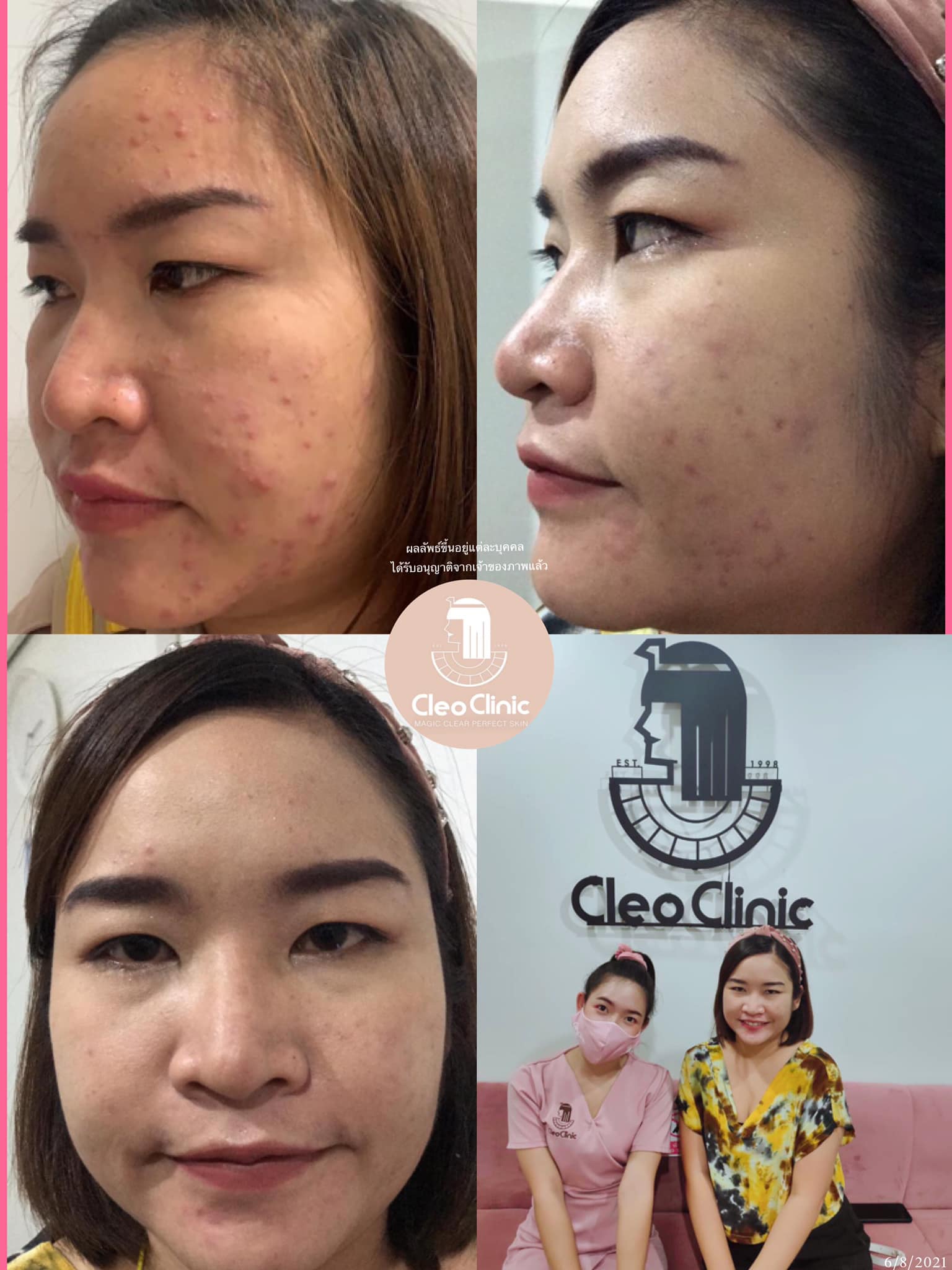 รีวิว ปี 62