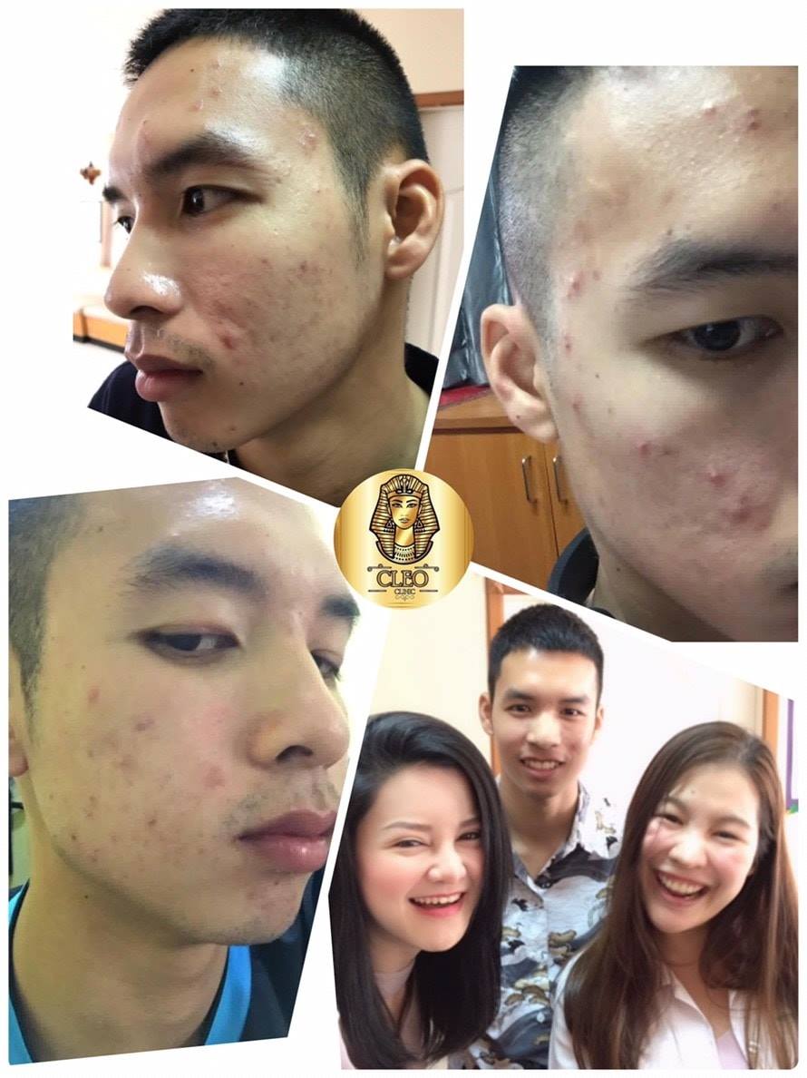 รีวิว ปี 62