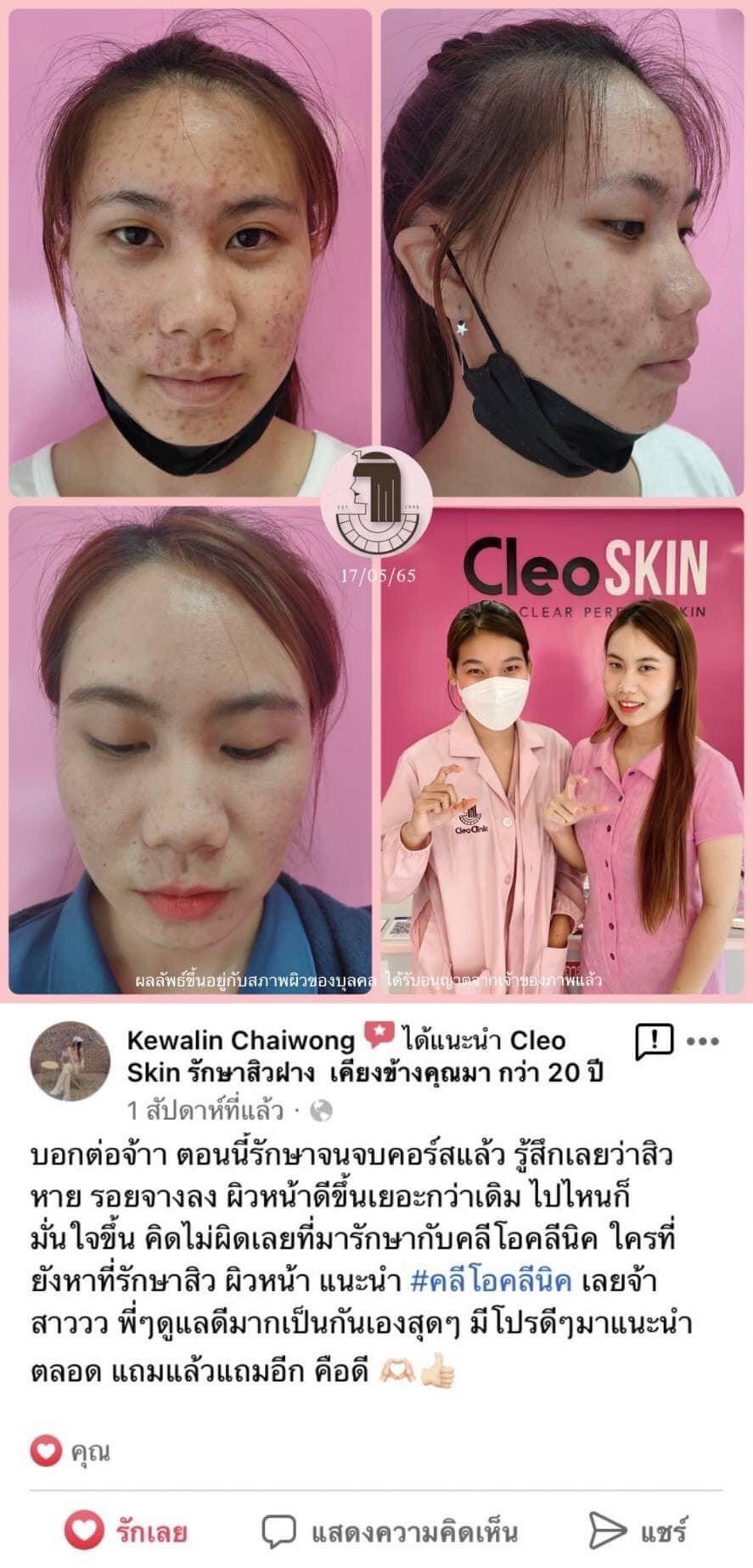 รีวิว ปี 62