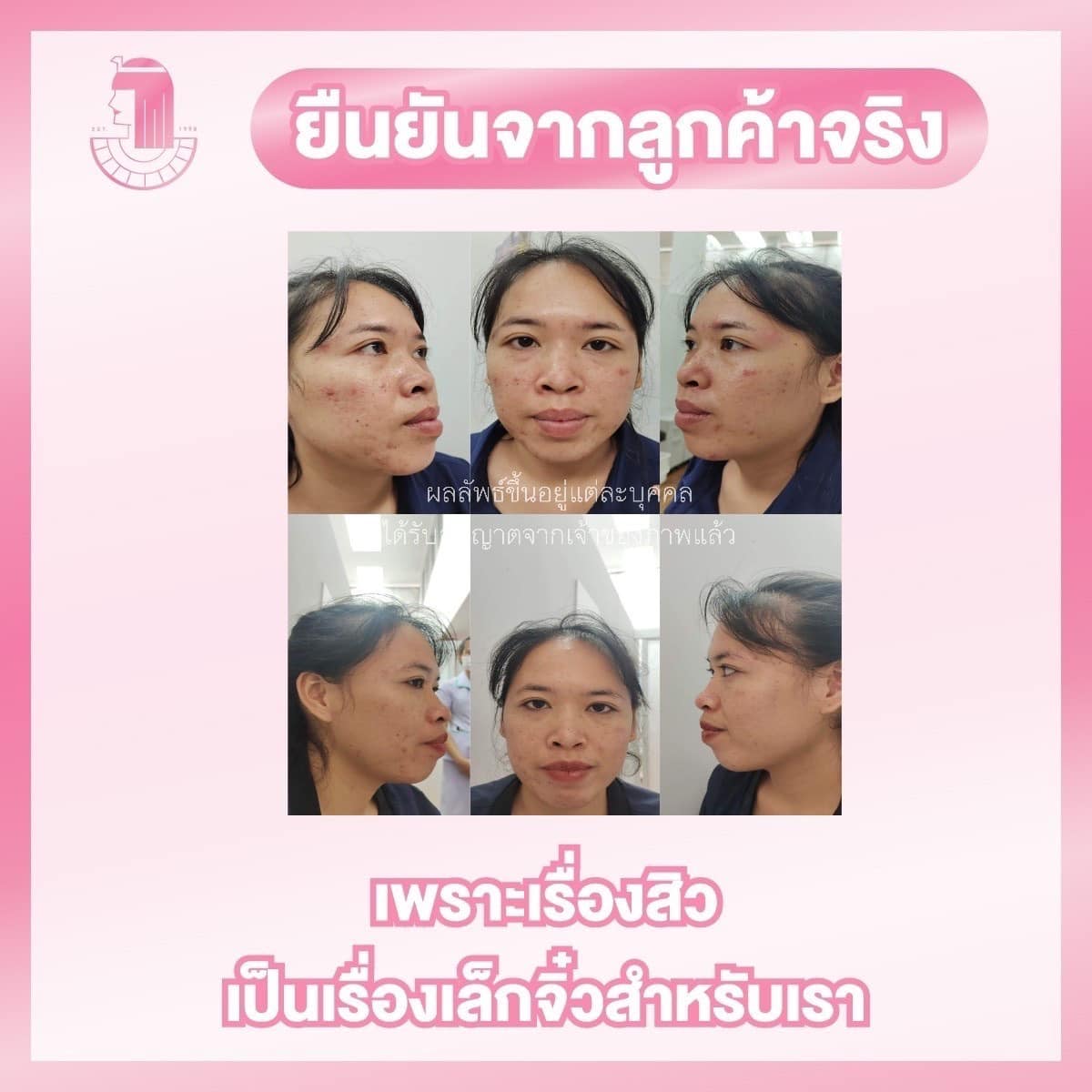 รีวิว ปี 62