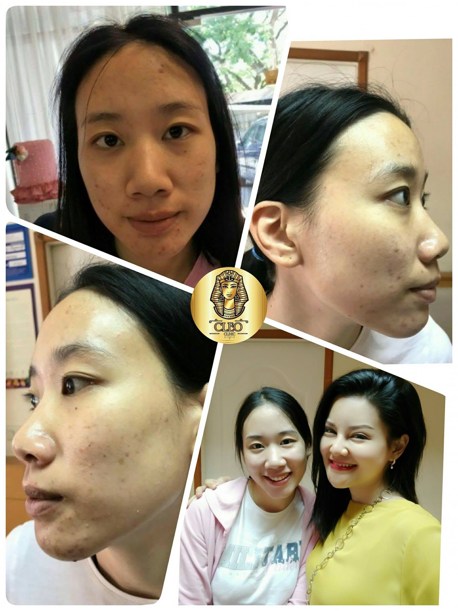 รีวิว ปี 62