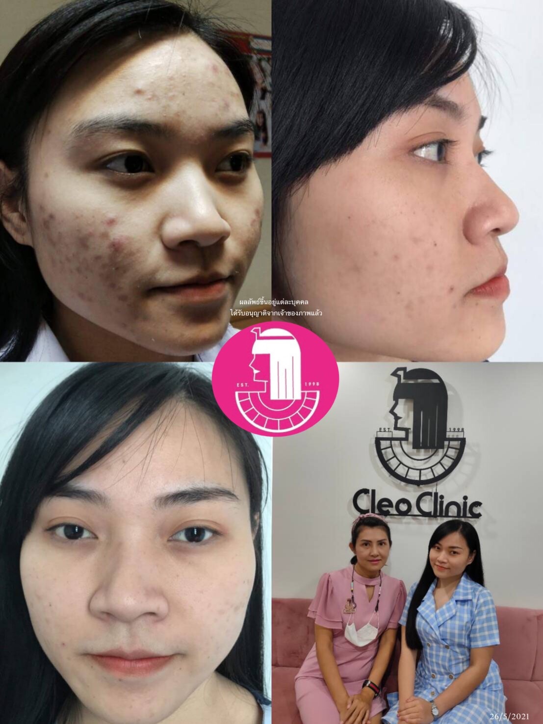 รีวิว ปี 62