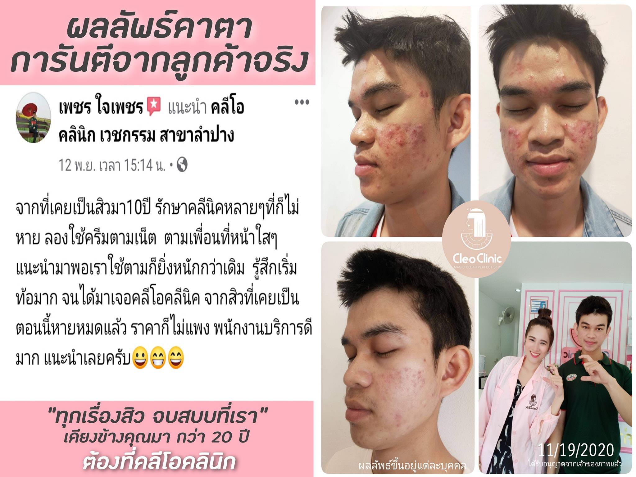 รีวิว ปี 62