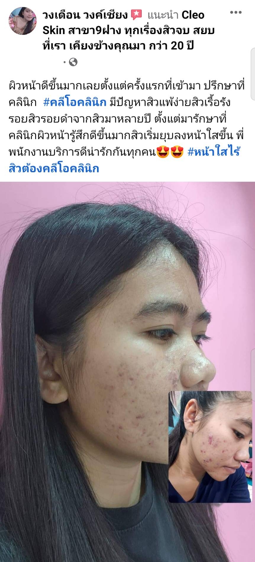 รีวิว ปี 62