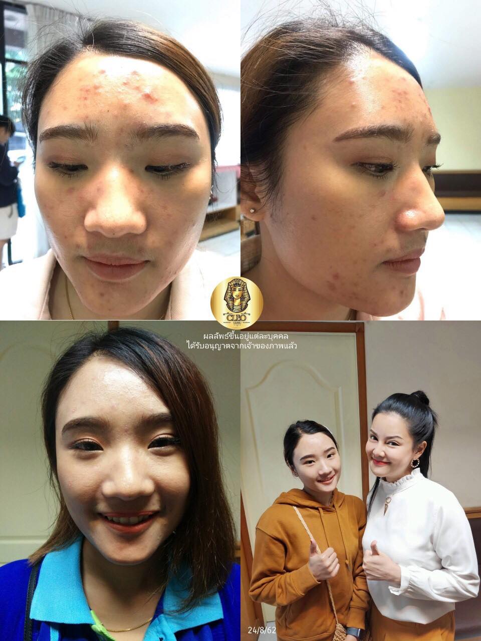 รีวิว ปี 62