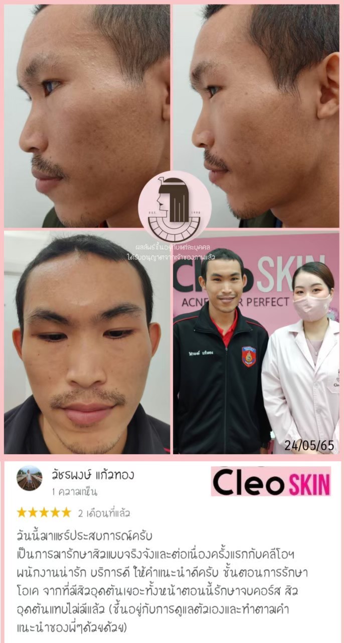 รีวิว ปี 62