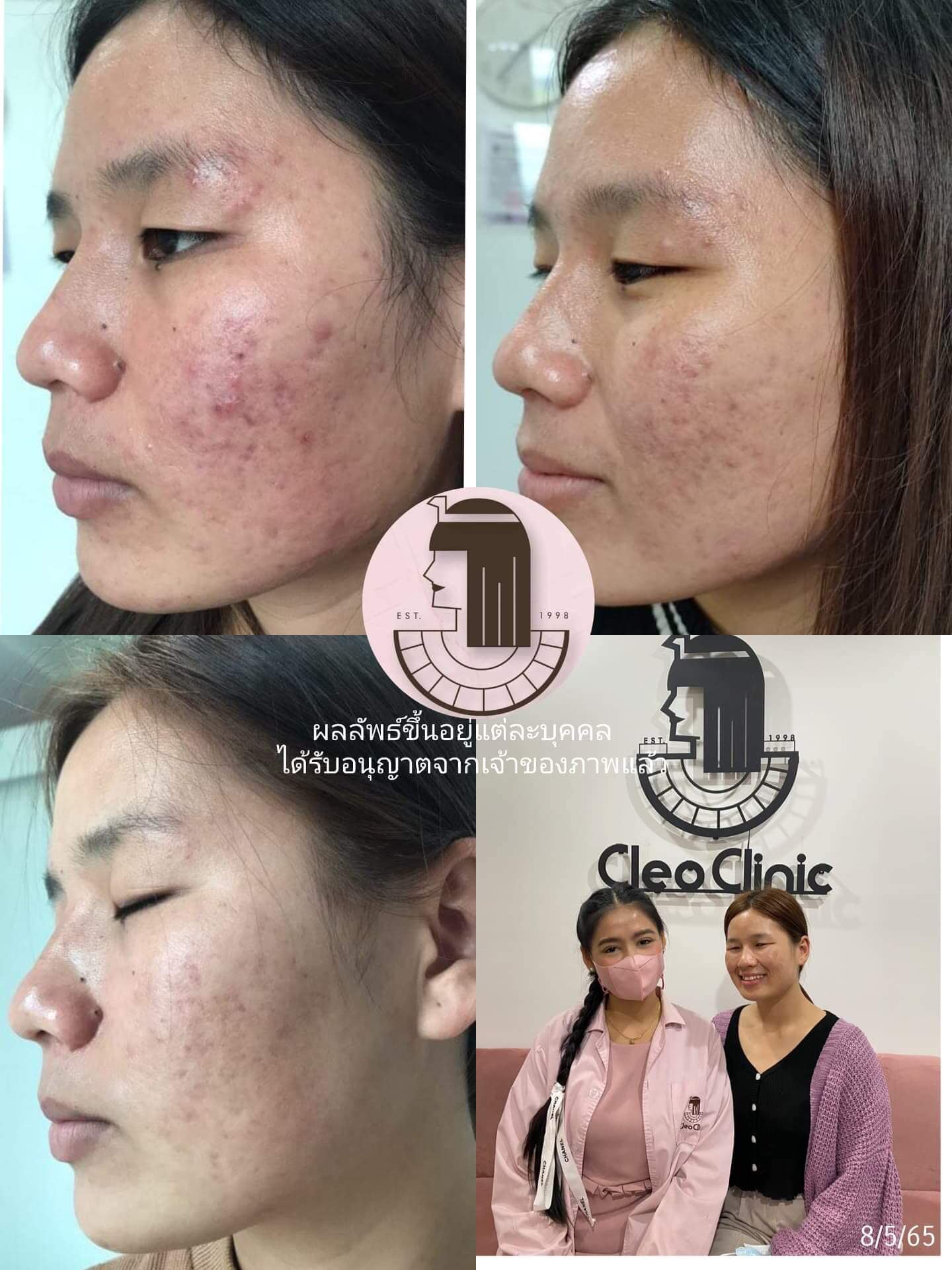 รีวิว ปี 62