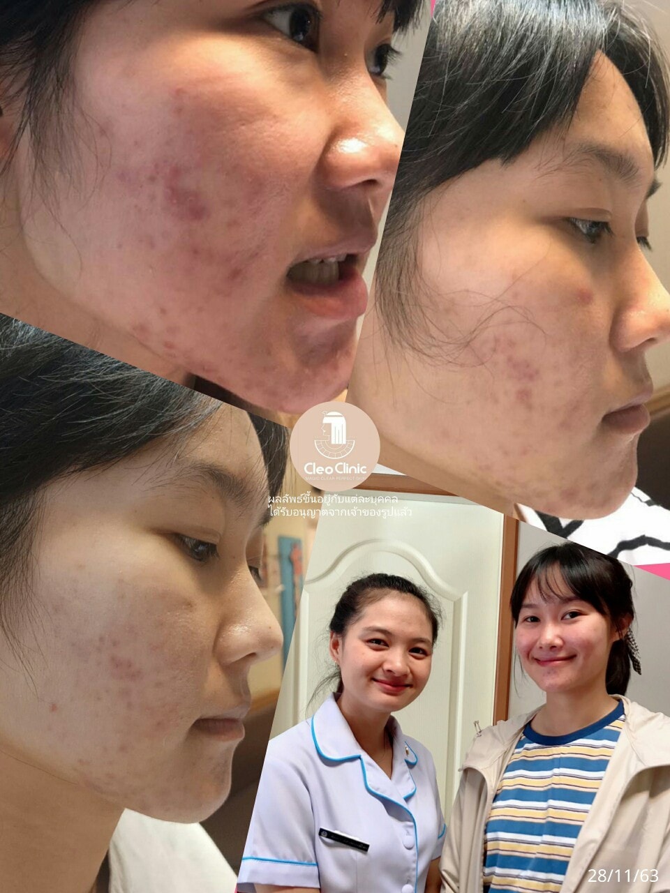 รีวิว ปี 62