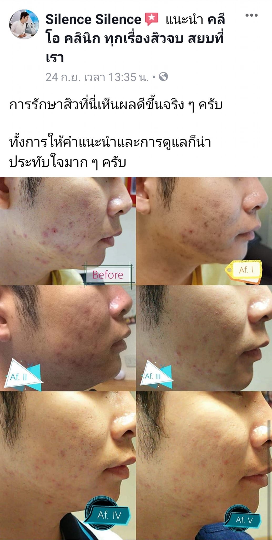 รีวิว ปี 62