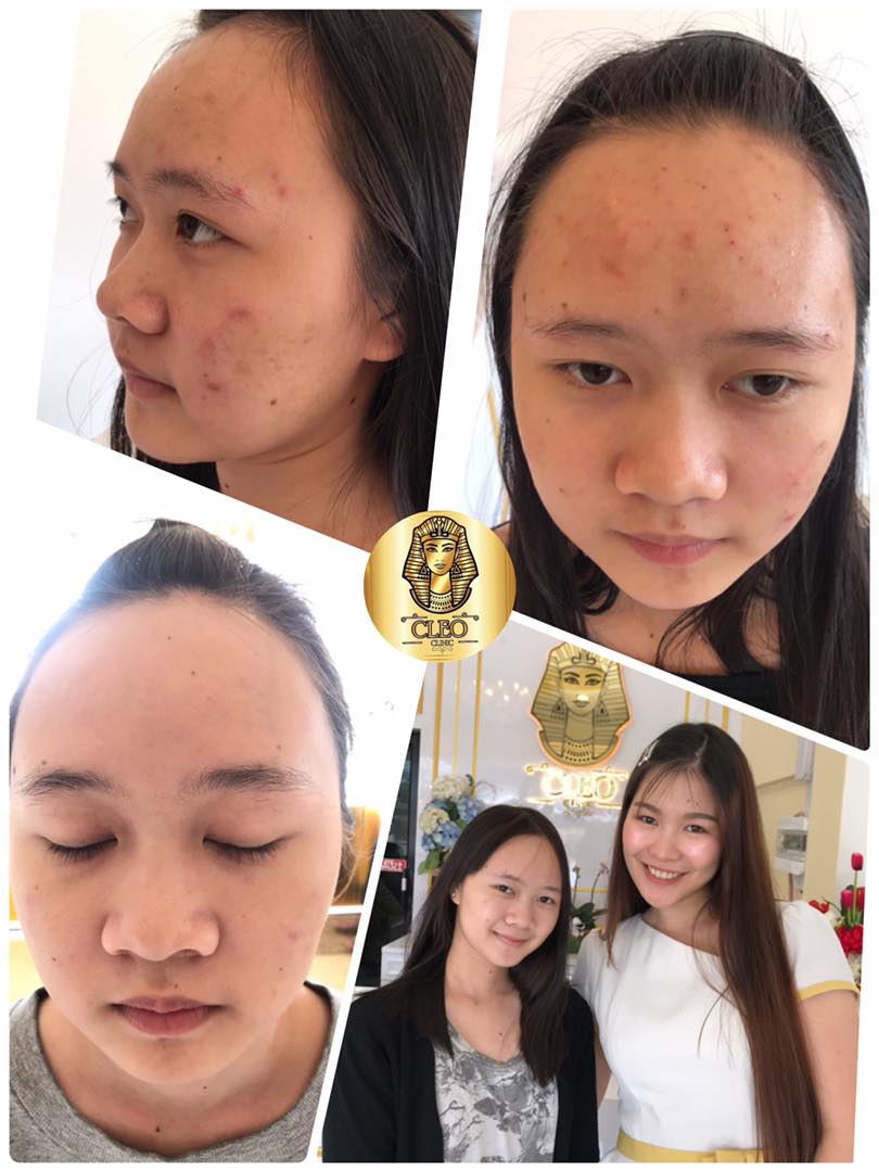 รีวิว ปี 62