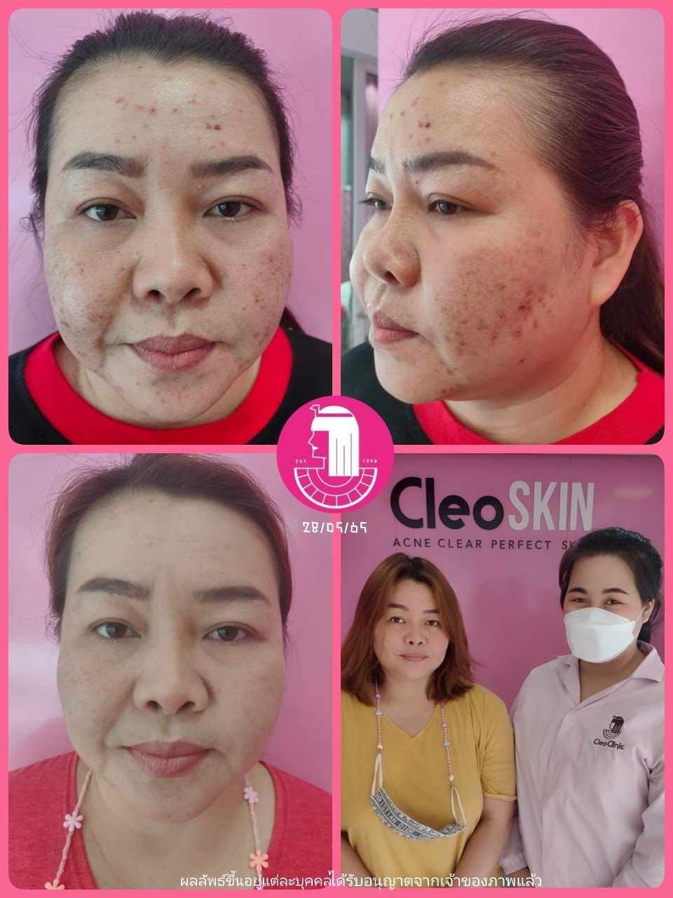 รีวิว ปี 62