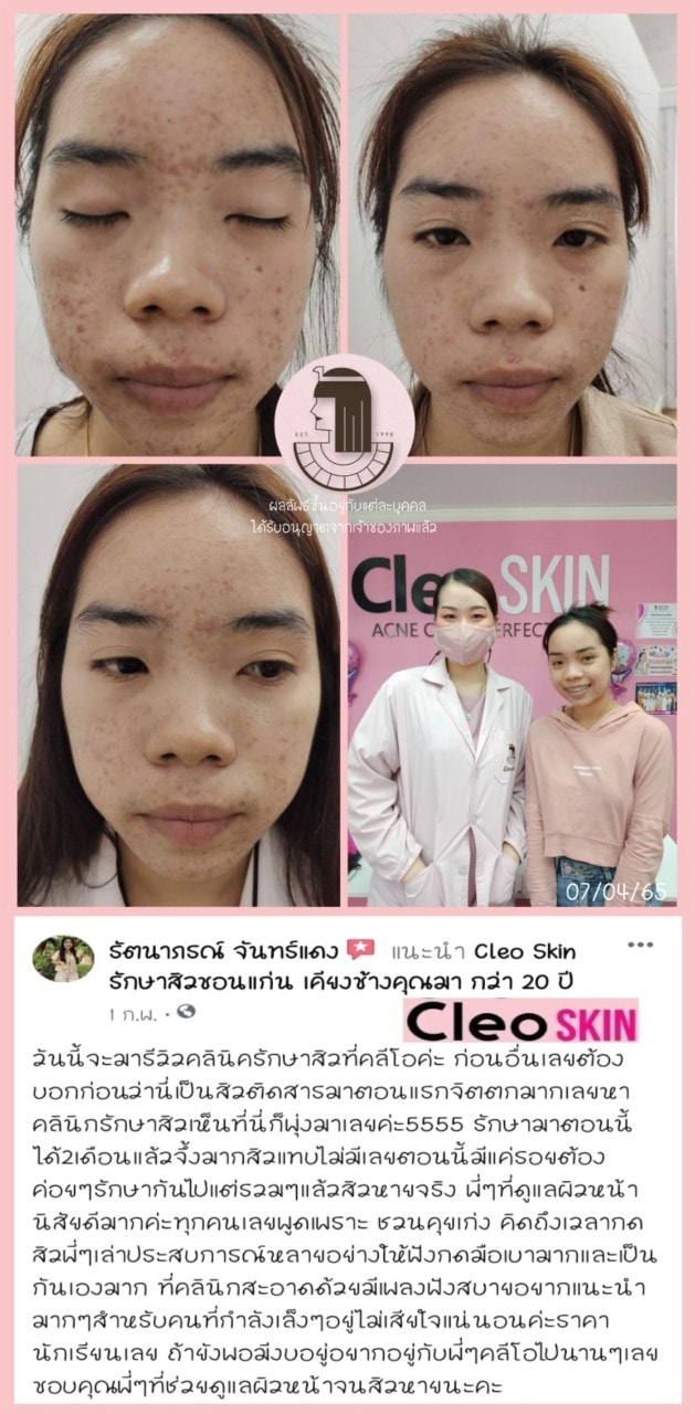 รีวิว ปี 62