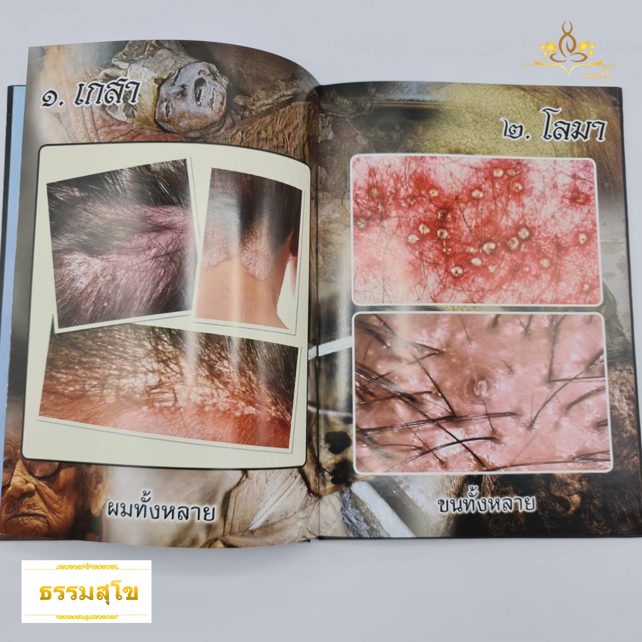 อสุภกรรมฐาน หลักธรรมชาติความจริงของร่างกายมนุษย์ อันนำไปสู่ความพ้นทุกข์