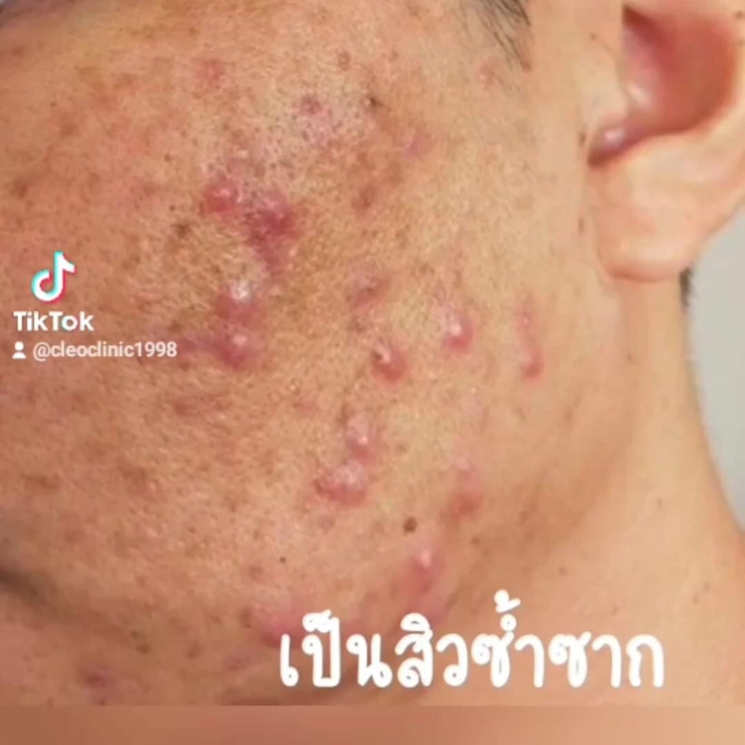 รีวิว ปี 62