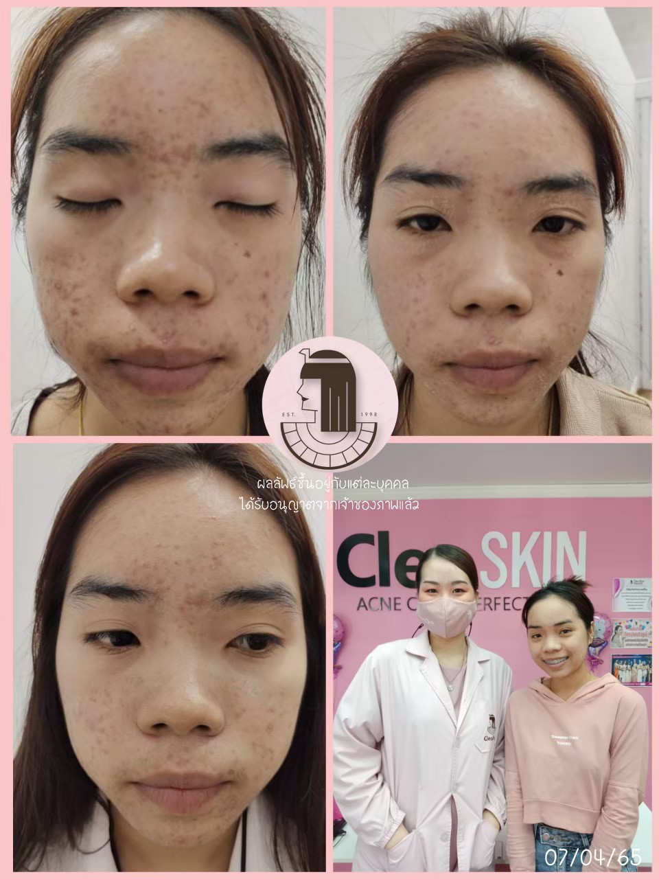 รีวิว ปี 62