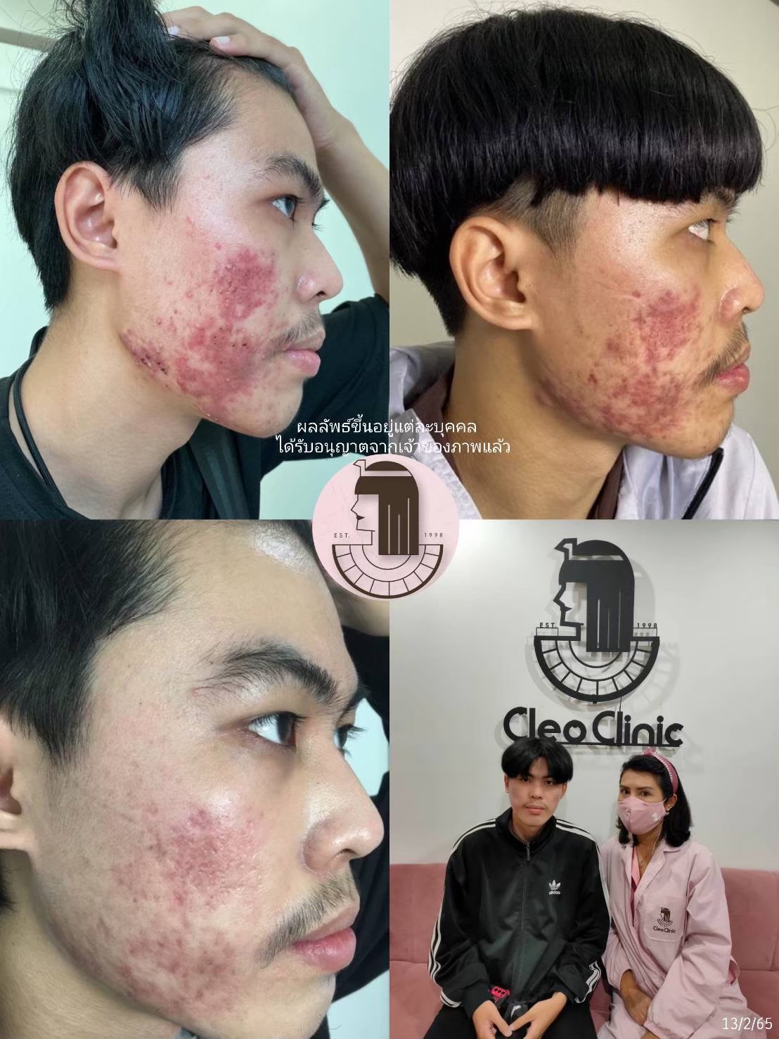 รีวิว ปี 62