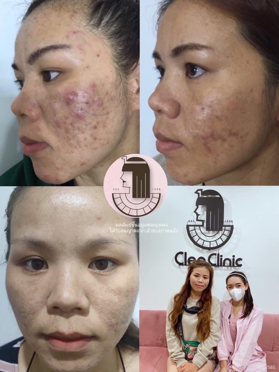 รีวิว ปี 62