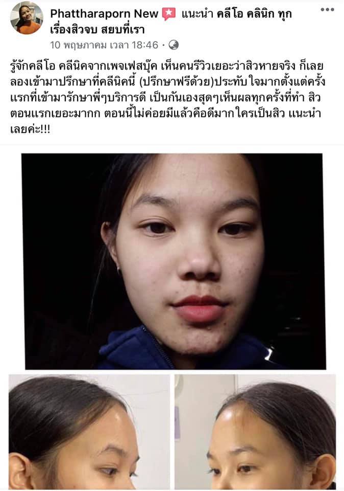 รีวิว ปี 62