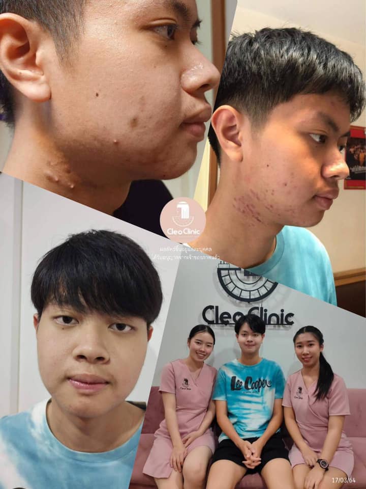 รีวิว ปี 62