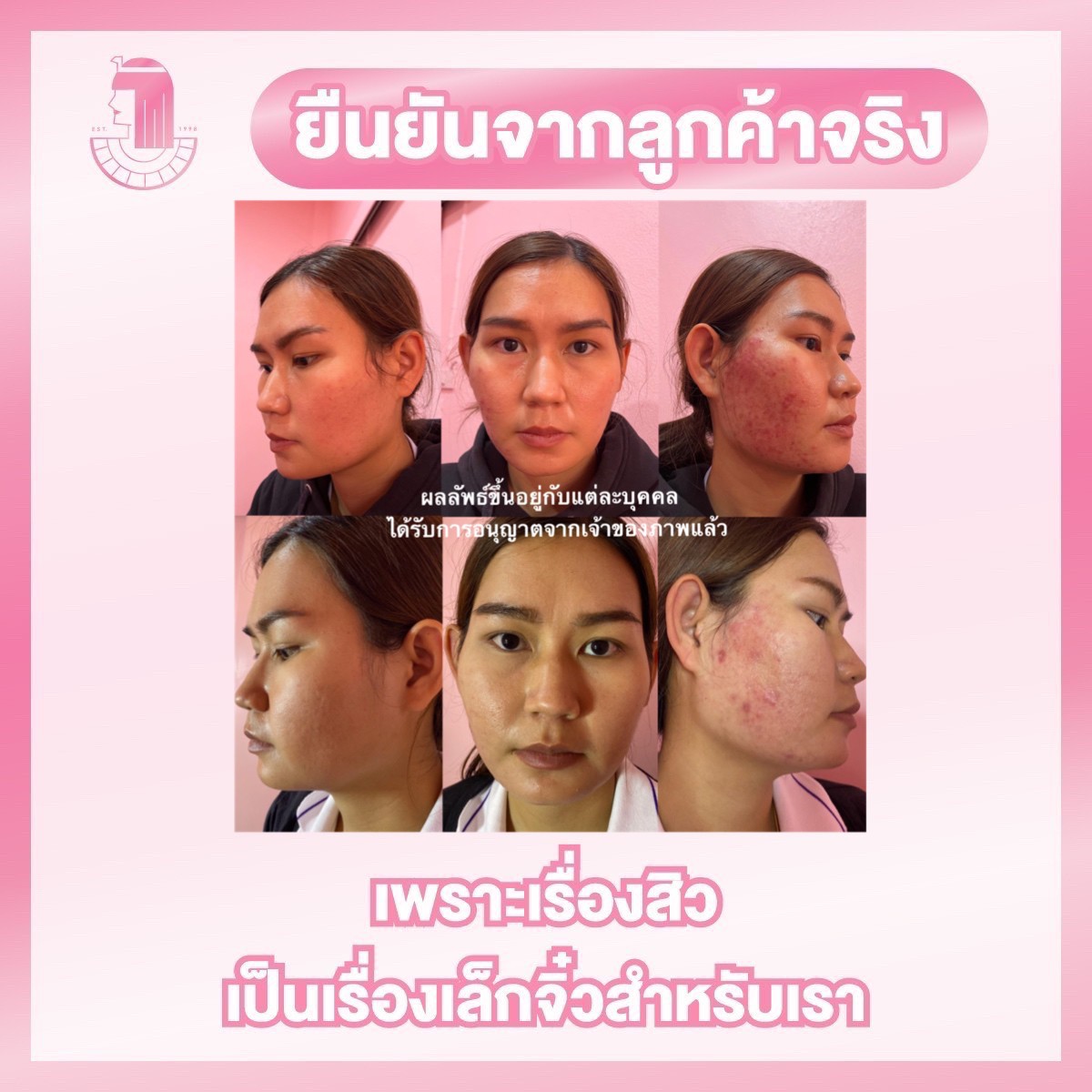 รีวิว ปี 62