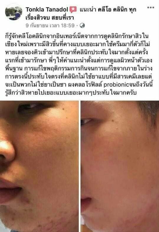 รีวิว ปี 62