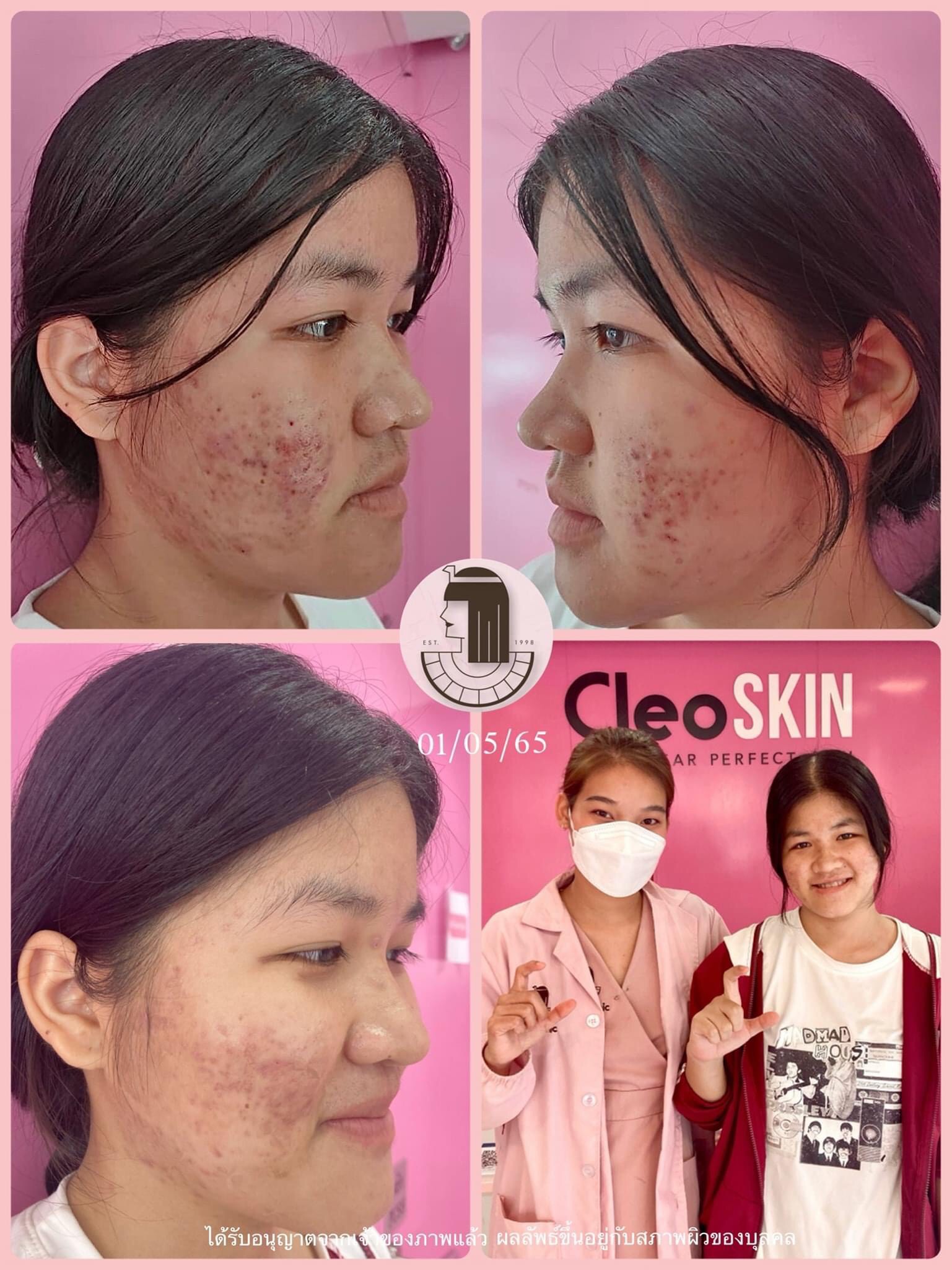 รีวิว ปี 62