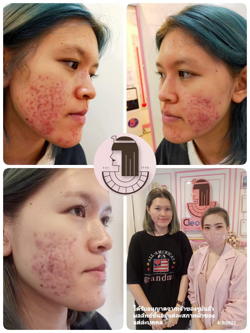 รีวิว ปี 62