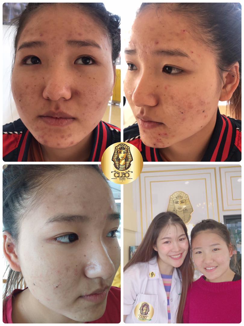 รีวิว ปี 62