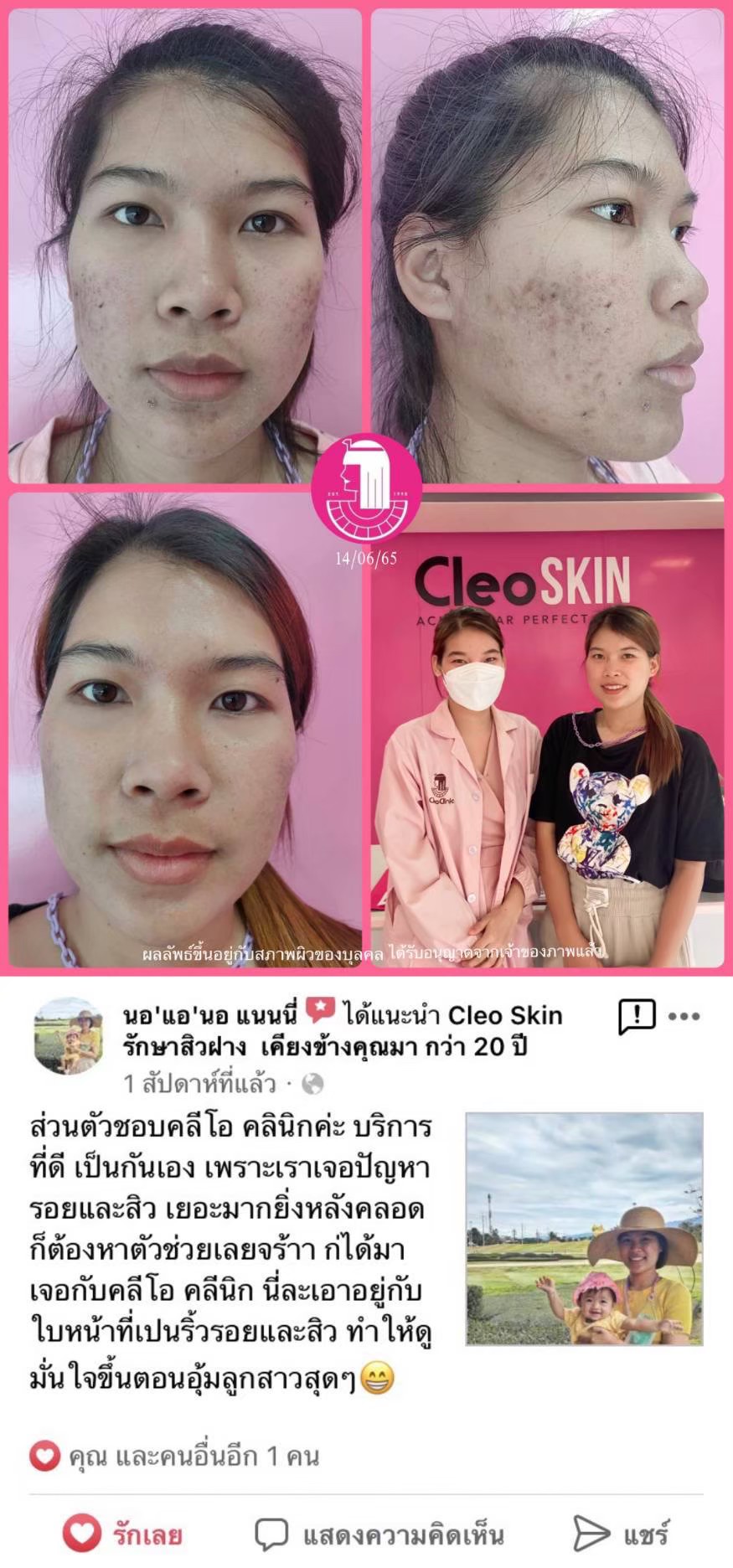 รีวิว ปี 62