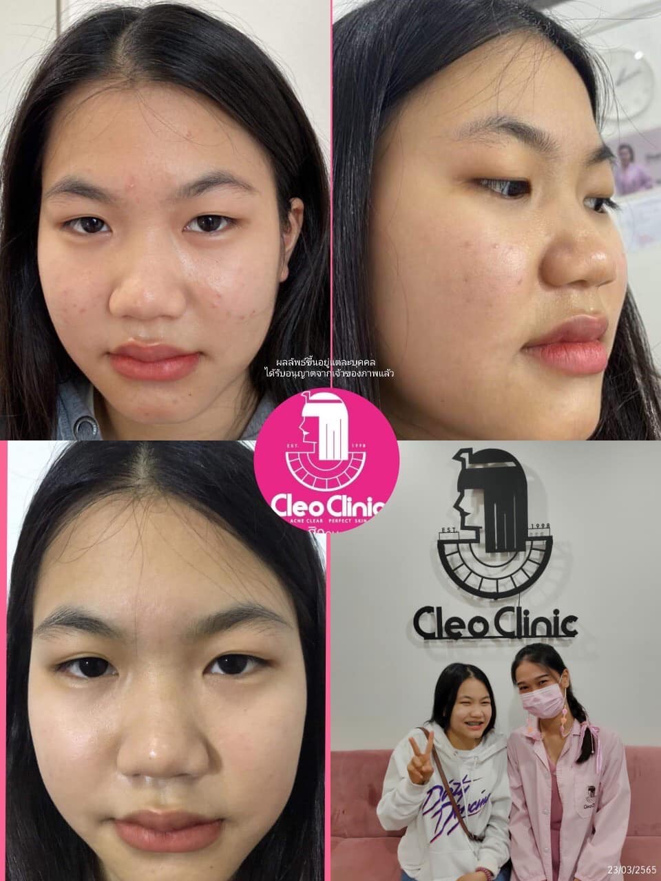 รีวิว ปี 62