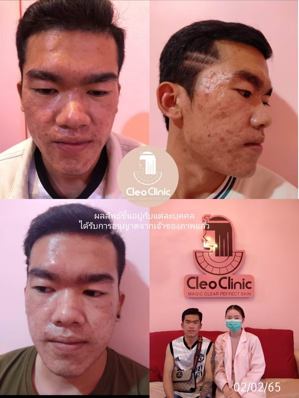 รีวิว ปี 62