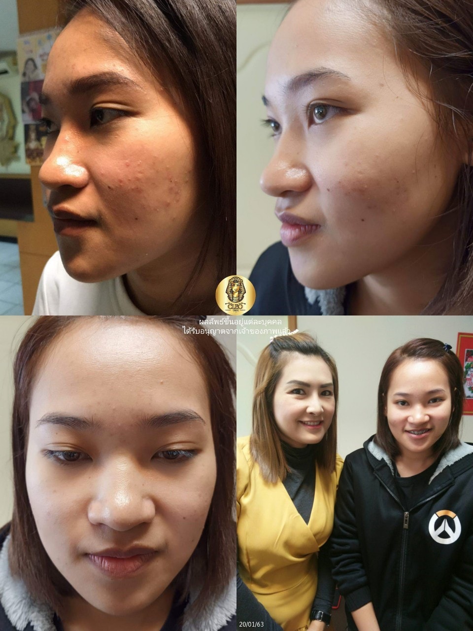 รีวิว ปี 62