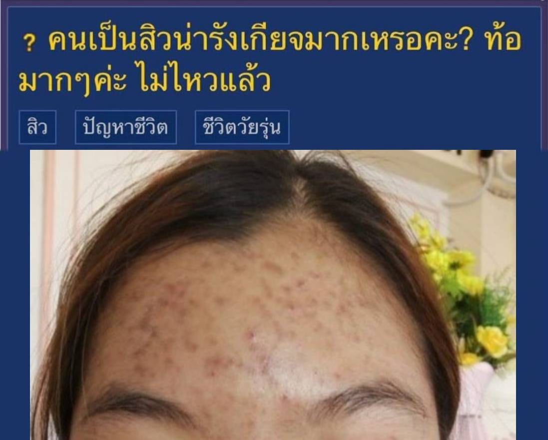 รีวิว ปี 62