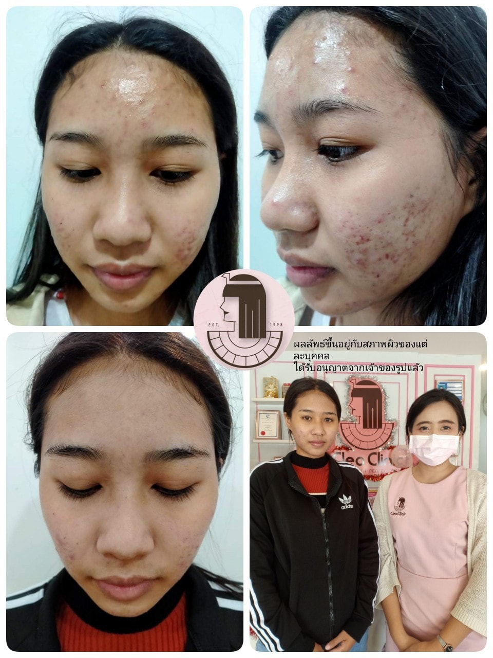 รีวิว ปี 62