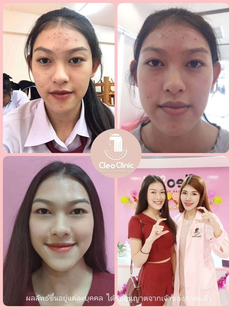 รีวิว ปี 62