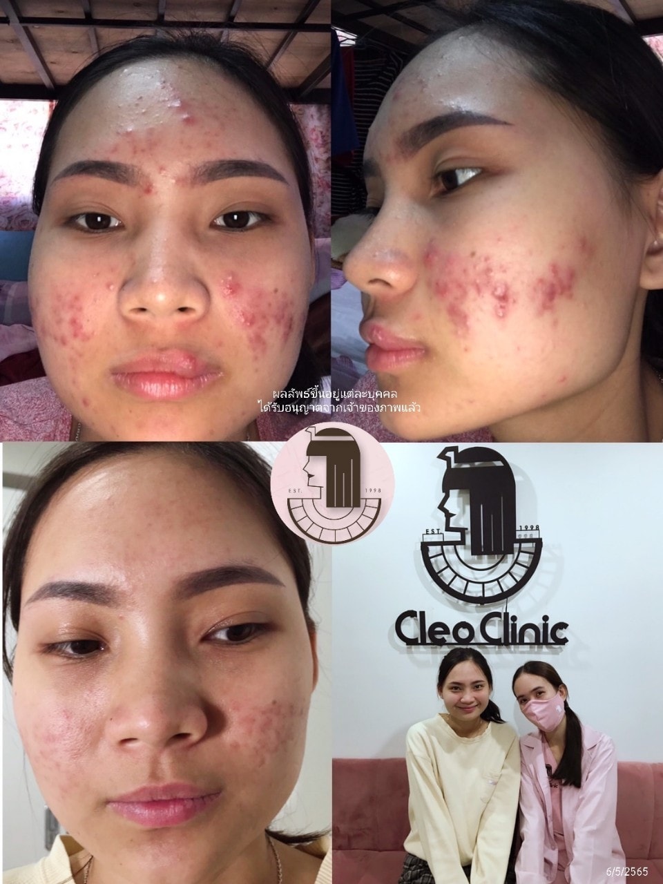 รีวิว ปี 62