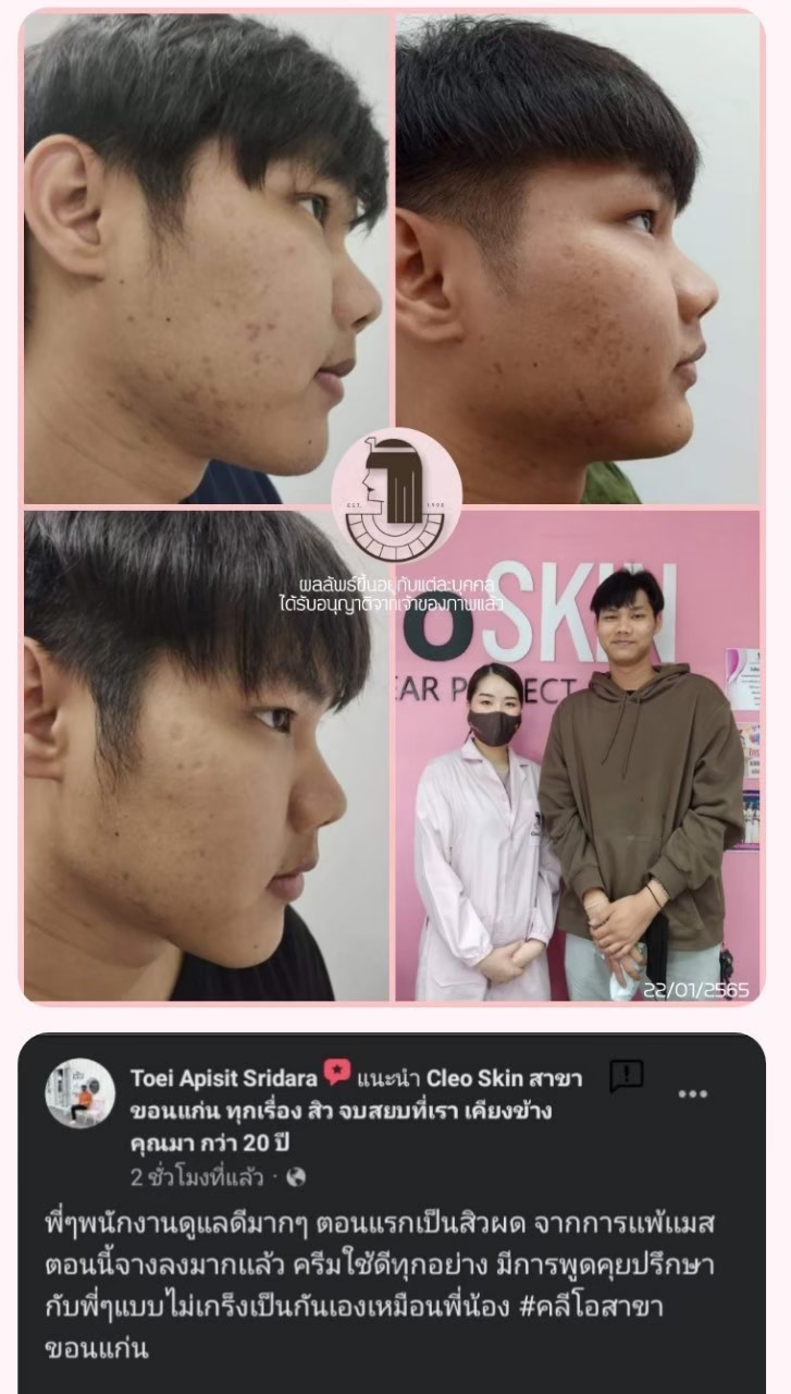 รีวิว ปี 62