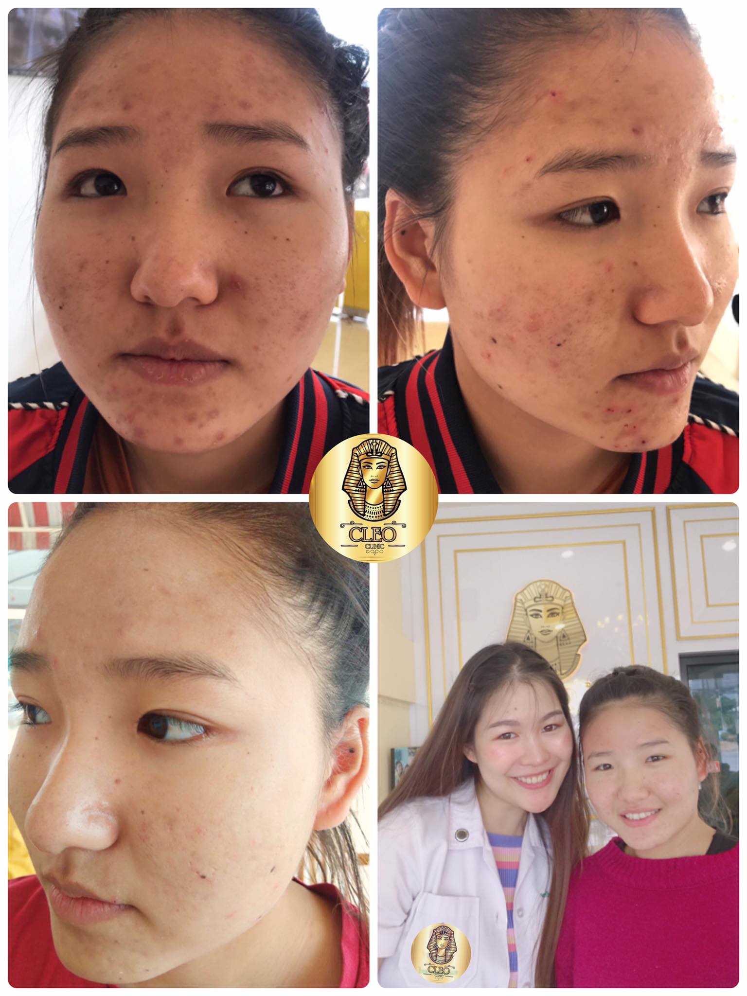 รีวิว ปี 62