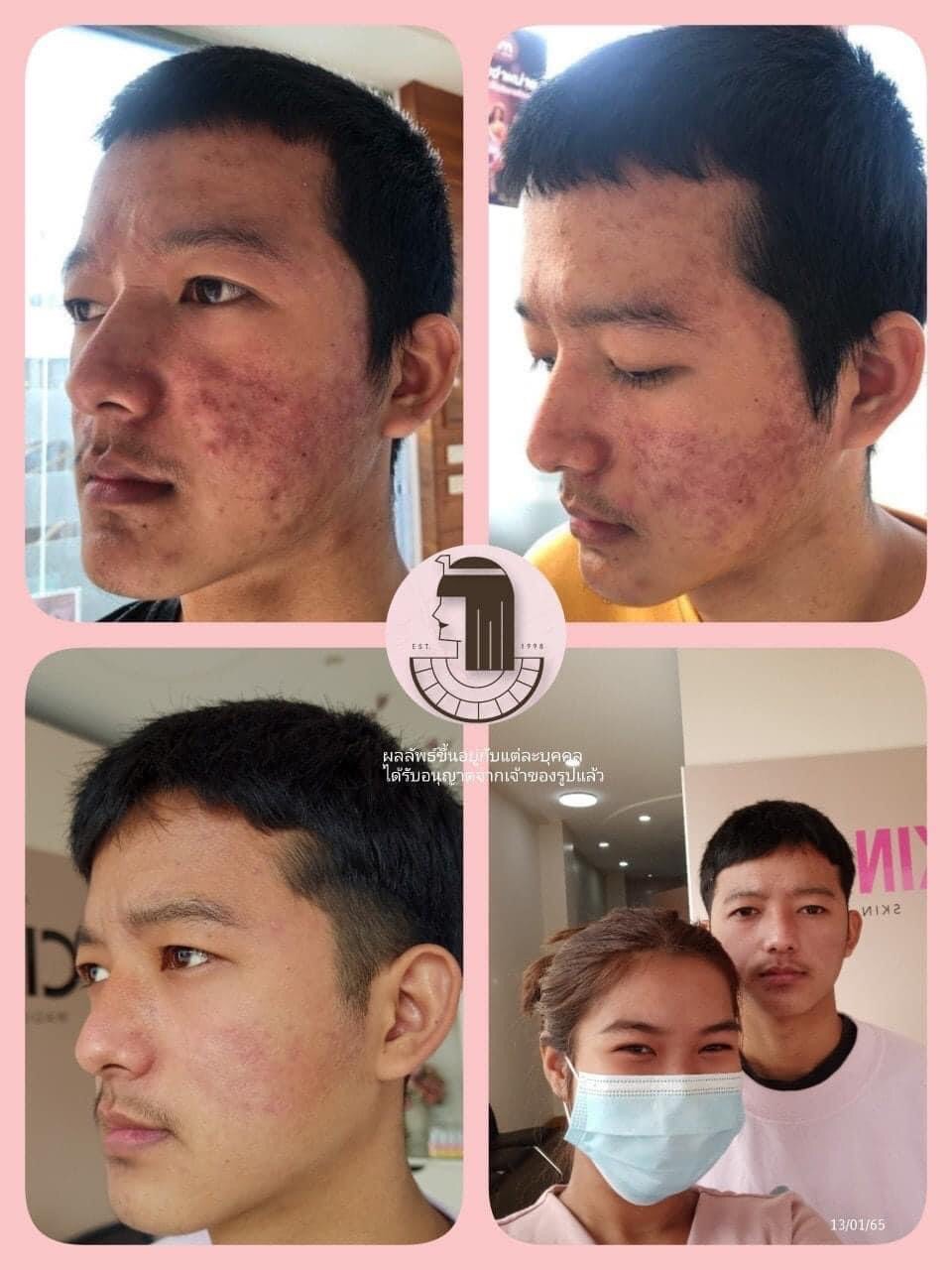 รีวิว ปี 62