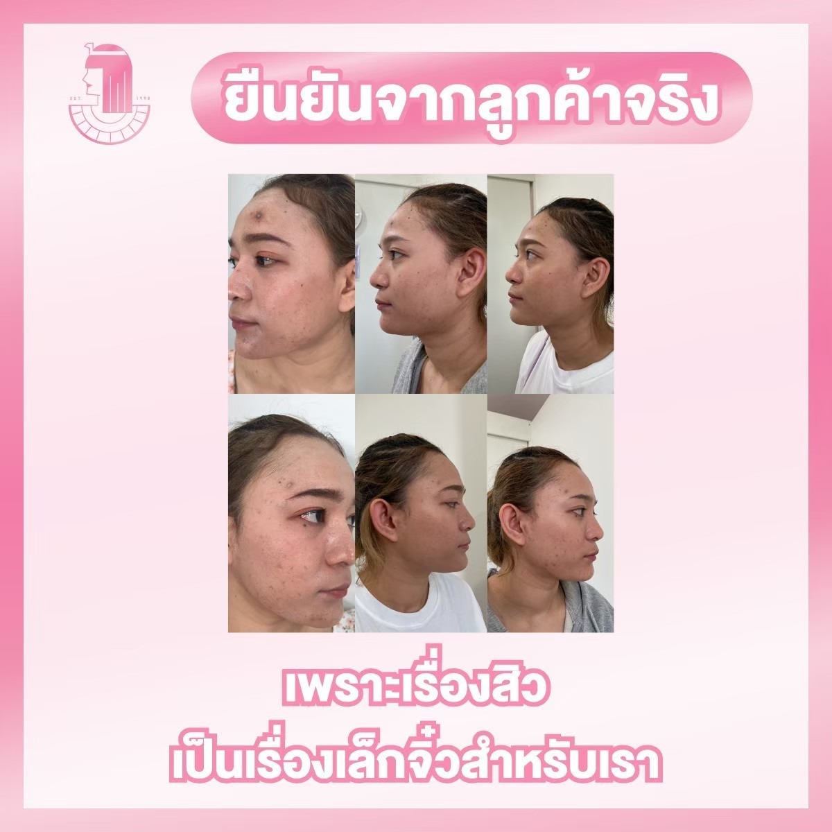 รีวิว ปี 62