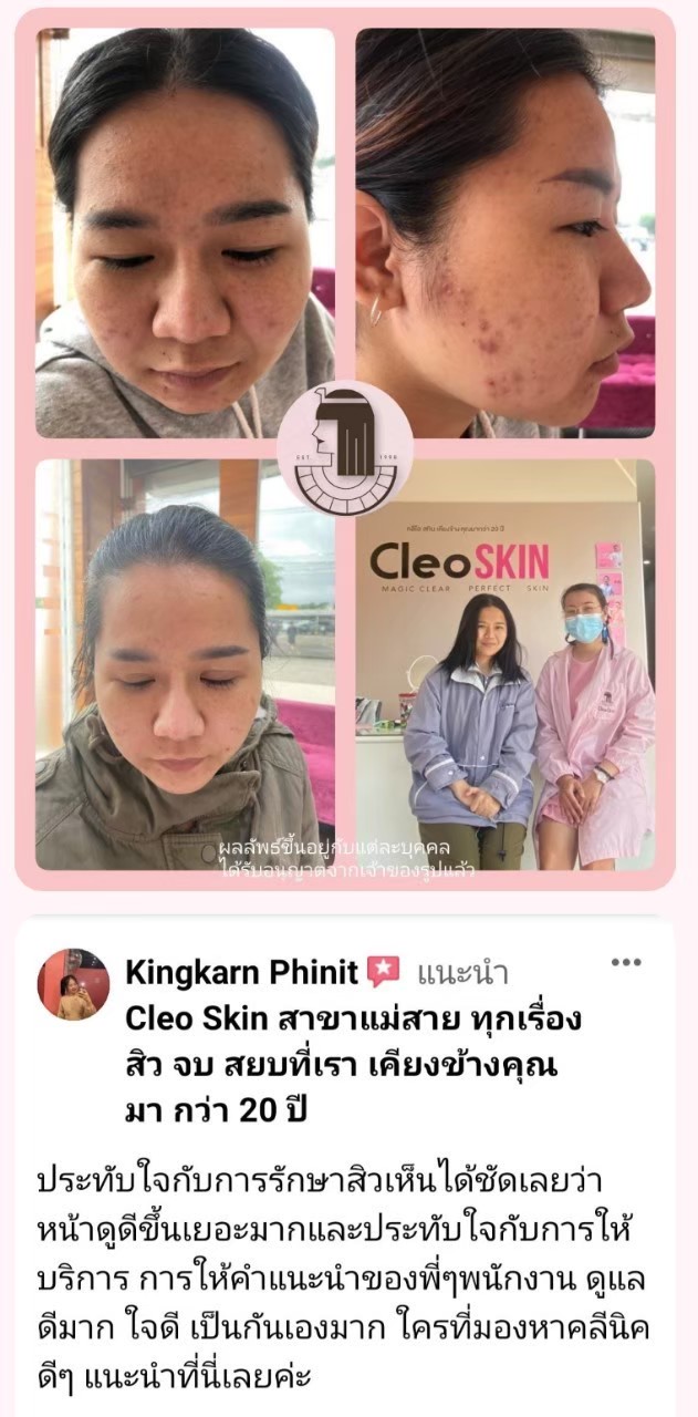 รีวิว ปี 62