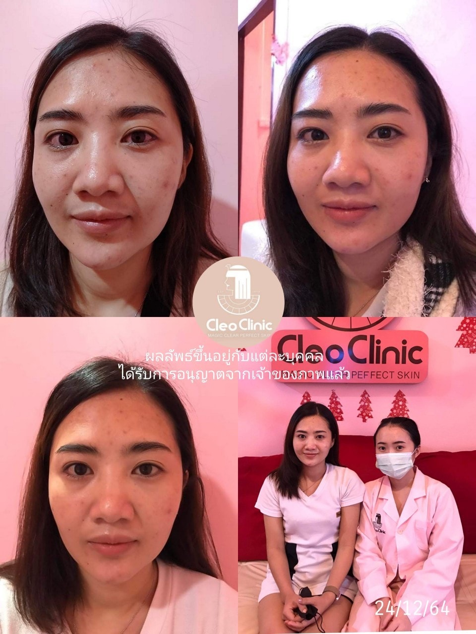 รีวิว ปี 62