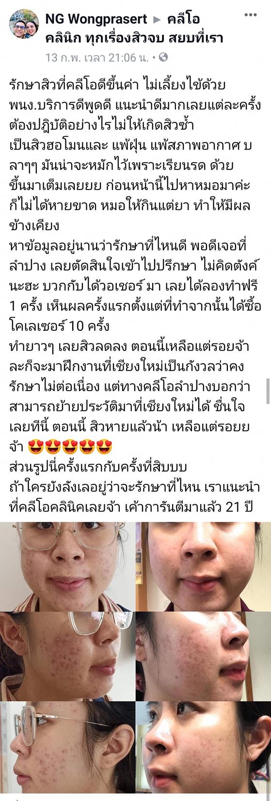 รีวิว ปี 62