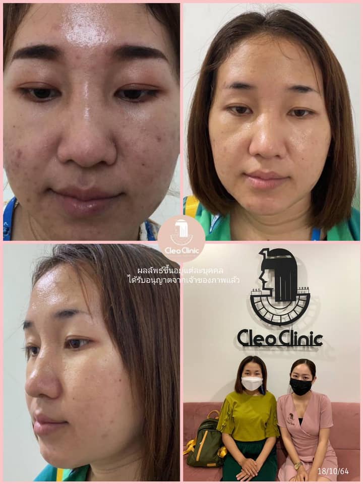 รีวิว ปี 62